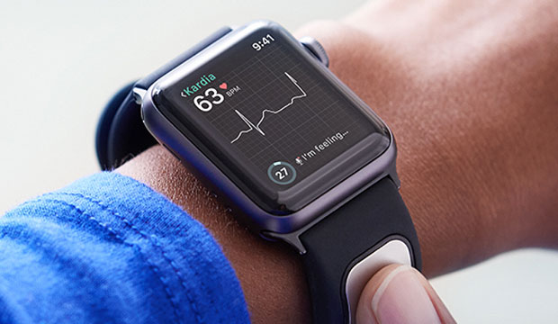 alivecor-kardiaband-apple-watch-ekg-reader