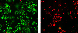 tumor cells