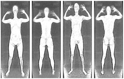 Backscatter scanner images