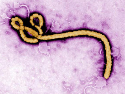 Ebola virus