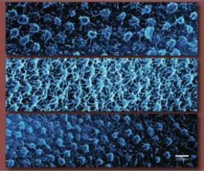 hydrogel nanoparticles