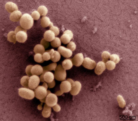 M. mycoides JCVI-syn1