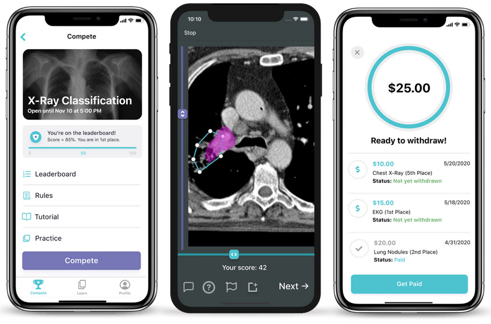 Captures d'écran de l'application mobile DiagnosUs